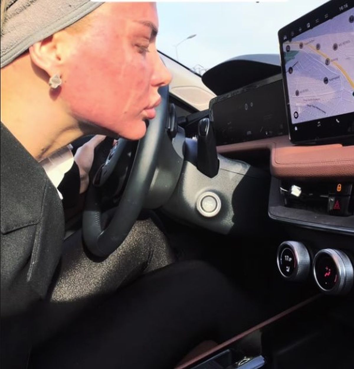 Lice u ožiljcima i crveno, voditeljka Pinka u panici: Usnimila sve, Kemez zabrinula javnost