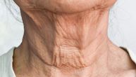 Bore na vratu nestaju bez igle: Prirodni TRIKOVI koji daju vidljive rezultate, samo budite uporni