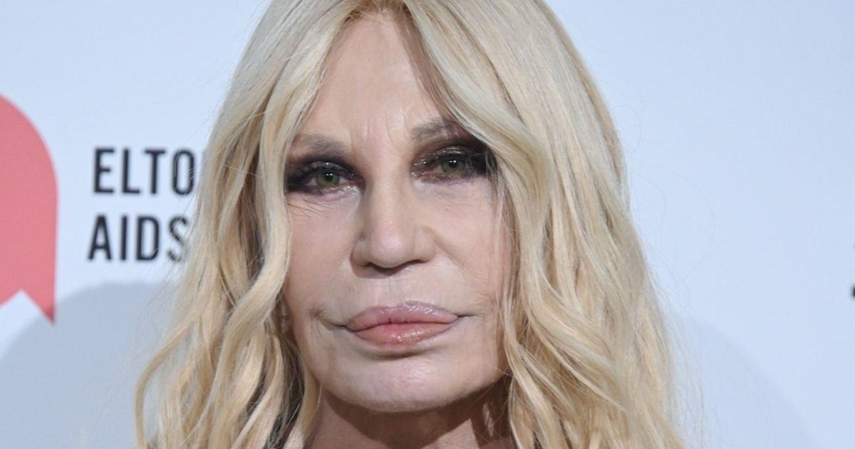 This is what Donatella Versace looked like before her surgeries: After her brother was killed, she surrendered to surgeons