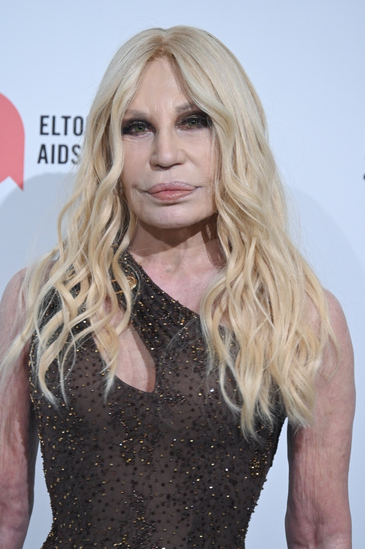 Ovako je Donatela Versače izgledala pre operacija: Nakon što su joj ubili brata, prepustila se hirurzima