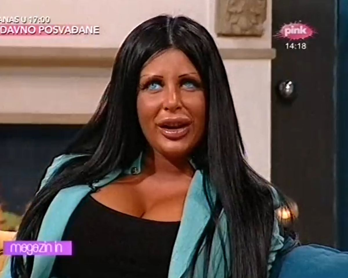 "Kraljica silikona" više ne izgleda kao plastična lutka! Šok, pogledajte sada Tijanu