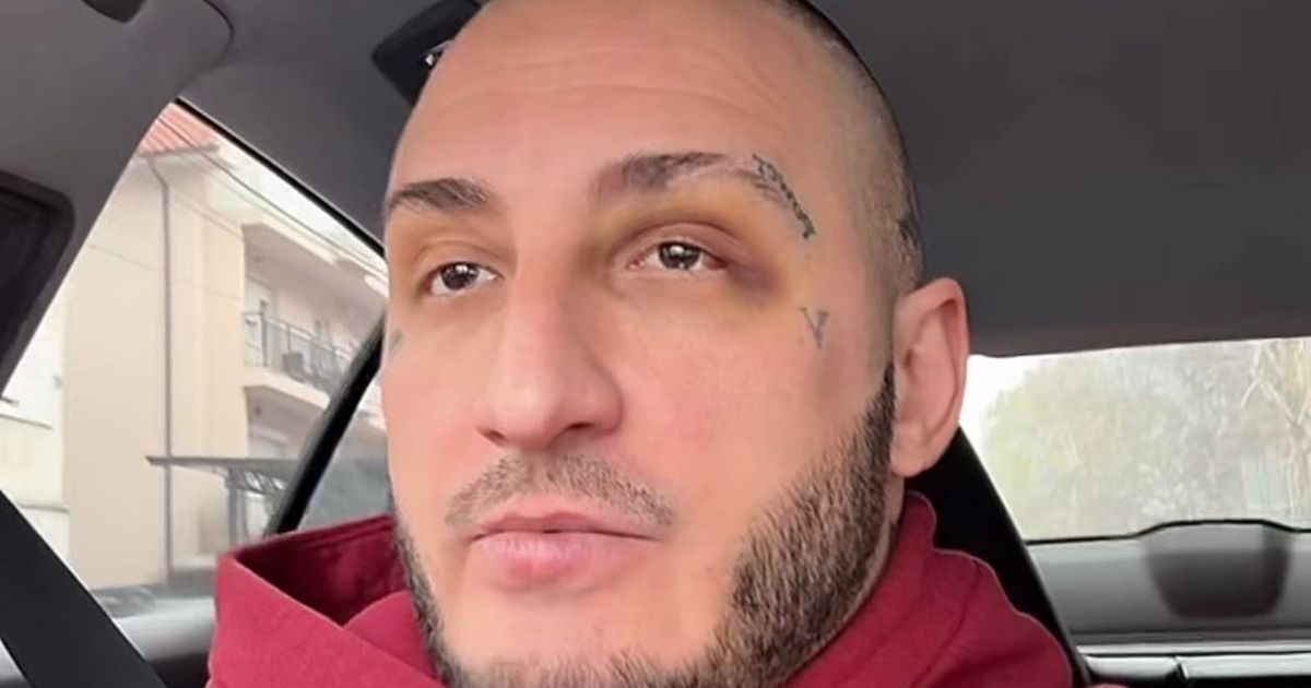 Pukle obe bubne opne, hitno posetio doktora! Vuku Mobu ugroženo zdravlje posle tuče sa Vasom Bakočevićem