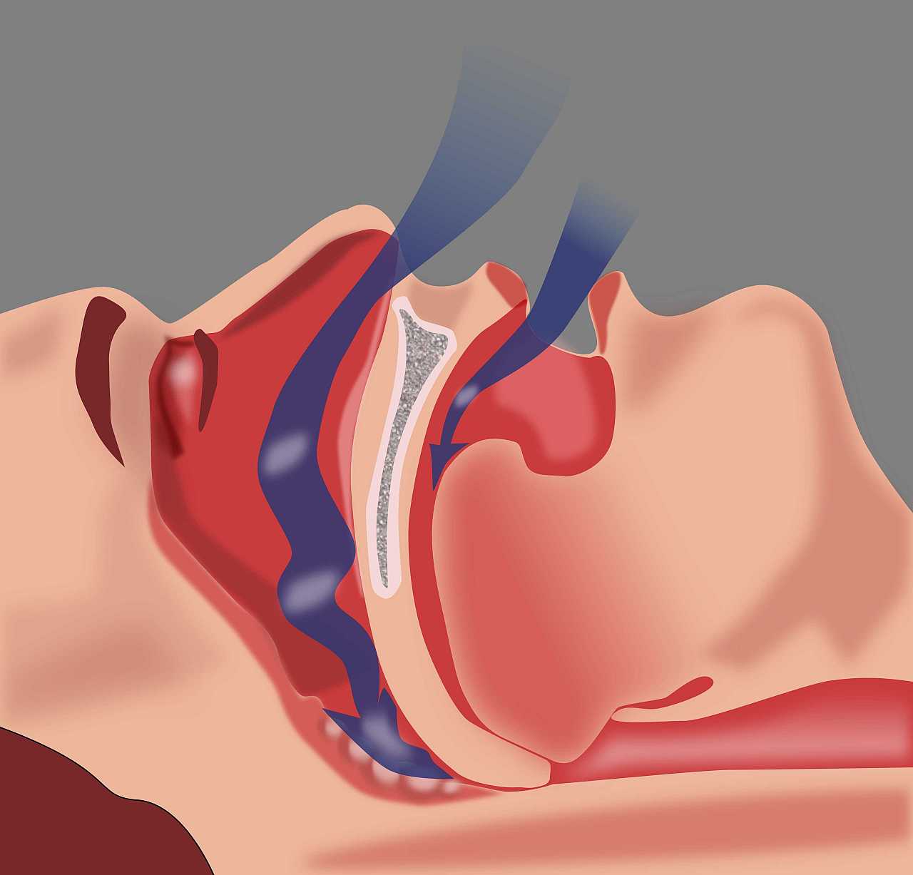Studija pokazuje povezanost između opstruktivne apneje u snu, opšte smrtnosti i kardiovaskularnih događaja