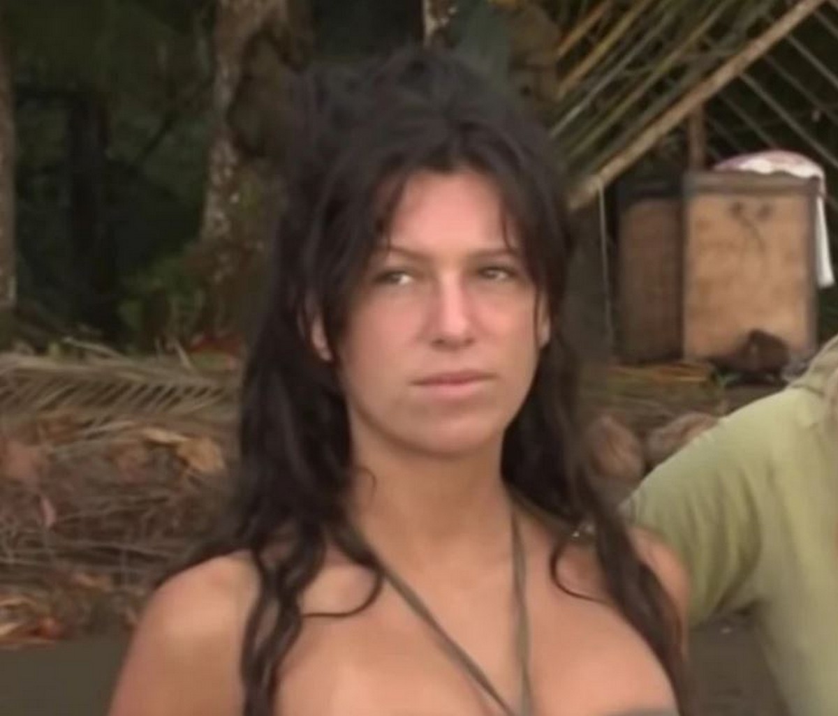 Estetska transformacija promenila joj život: Stanija je ovako izgledala pre operacija, isplivale stare slike