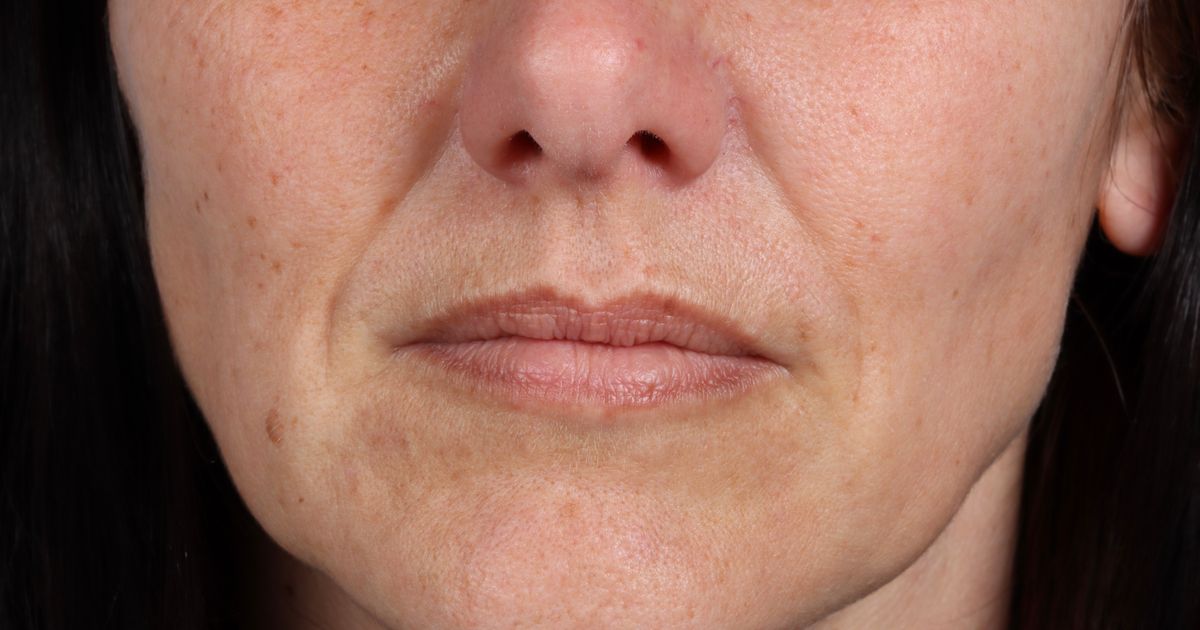 Nisu samo godine krive: Ova stvar pravi bore i kad koristite najbolju kozmetiku