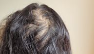 Želite gušću kosu? Ovi prirodni saveti za rast i volumen zaista rade, kažu frizeri