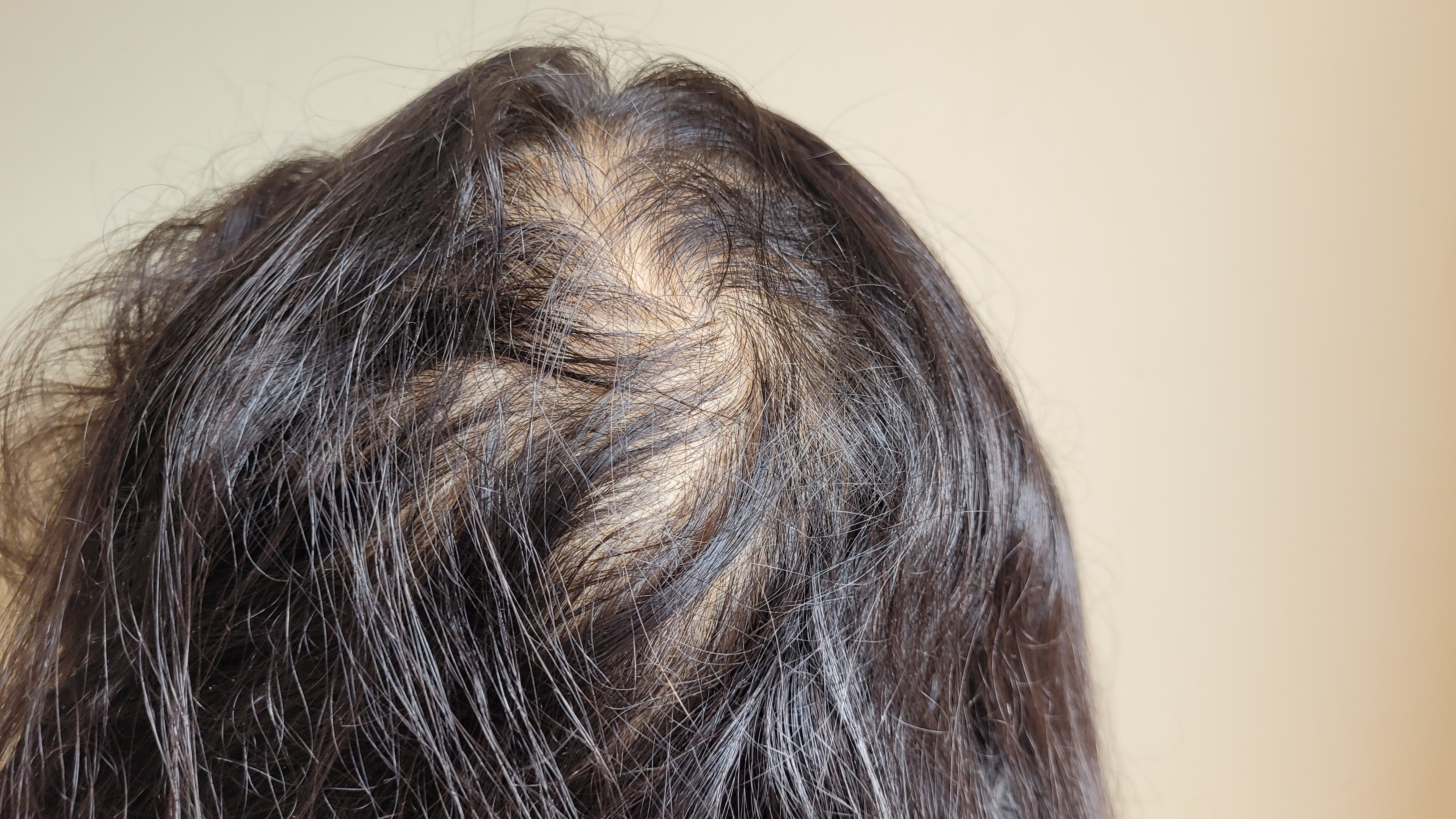 Želite gušću kosu? Ovi prirodni saveti za rast i volumen zaista rade, kažu frizeri