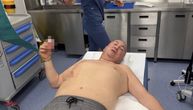 Prva slika Đanija nakon što je izujedan na svadbi: Folker u bolnici, leži bez majice na stolu sa ranom