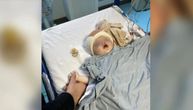 Tata Luka vrisnuo, babica pretrnula od šoka na porođaju: Ovom mališanu su četiri meseca bile zašivene oči