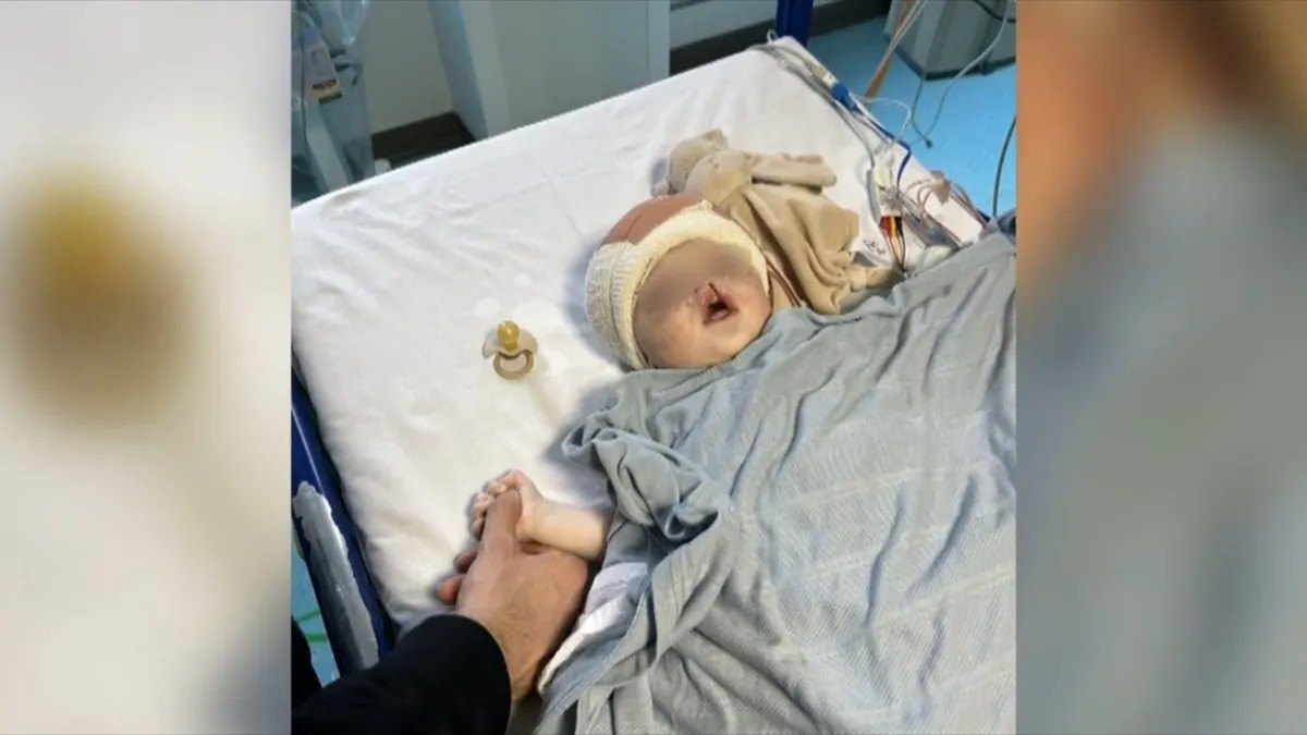 Tata Luka vrisnuo, babica pretrnula od šoka na porođaju: Ovom mališanu su četiri meseca bile zašivene oči