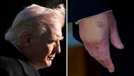 Tramp ide već treći put u bolnicu za 13 meseci: Šta se dešava sa predsednikom Amerike?