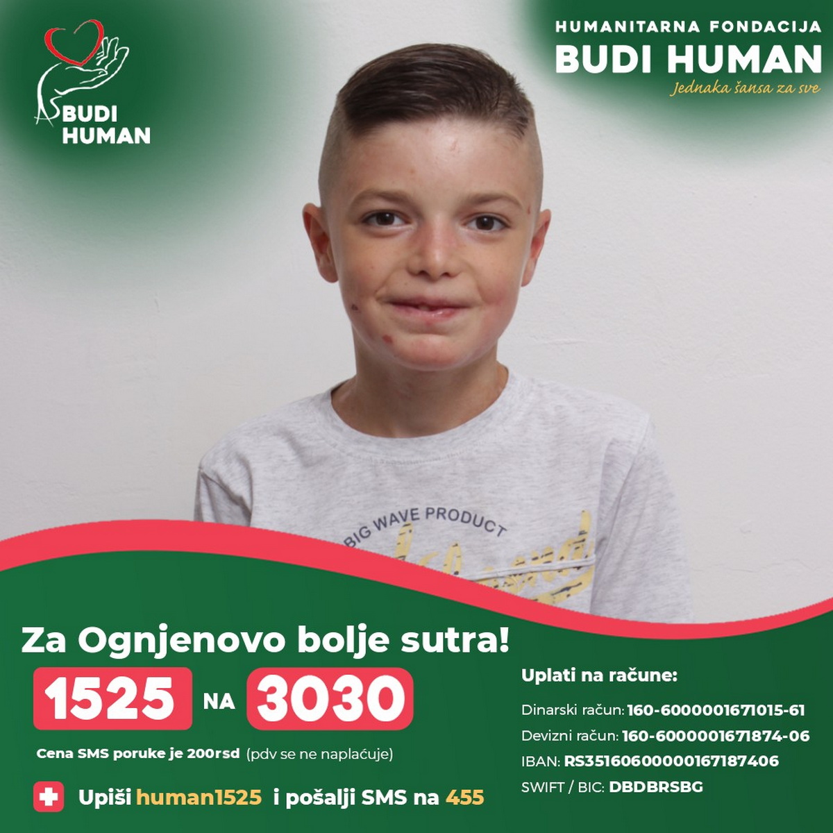 Dok druga deca bezbrižno odrastaju, Ognjen vodi surovu bitku za svaki novi dan: Potrebna mu je naša pomoć