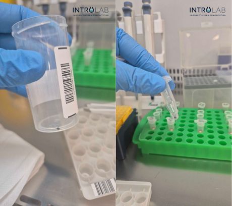 IntroLab laboratorija omogućava brzu i preciznu dijagnostiku nakon ujeda krpelja,