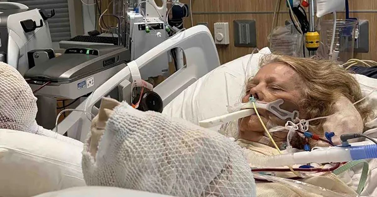 Женщина (82) заснула на солнце и теперь борется за жизнь: «Каждая часть тела, касавшаяся стула, была обожжена»