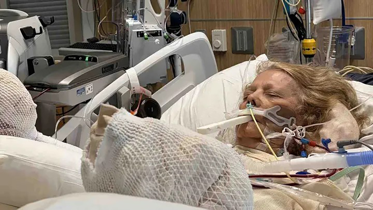 Žena (82) zaspala na suncu, sada se bori za život: "Svaki deo tela koji je dotakao stolicu bio je spržen"