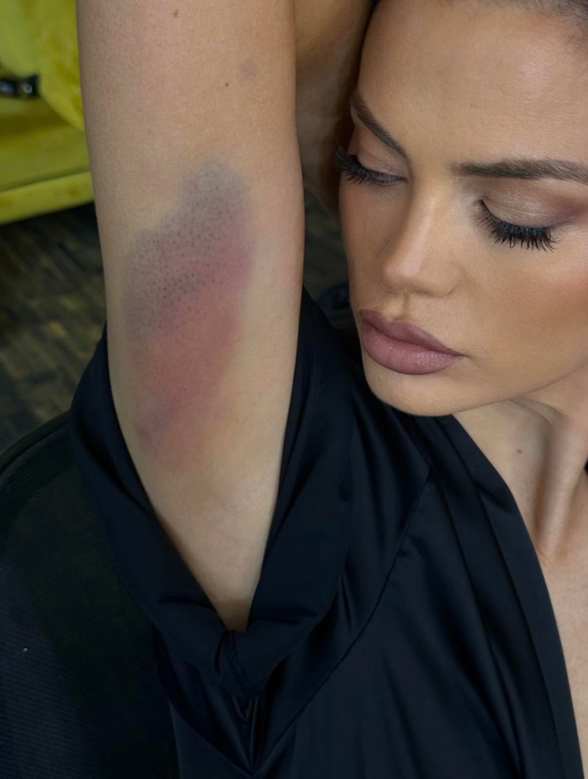 Celo telo u podlivima: Milica Pavlović se povredila na snimanju spota