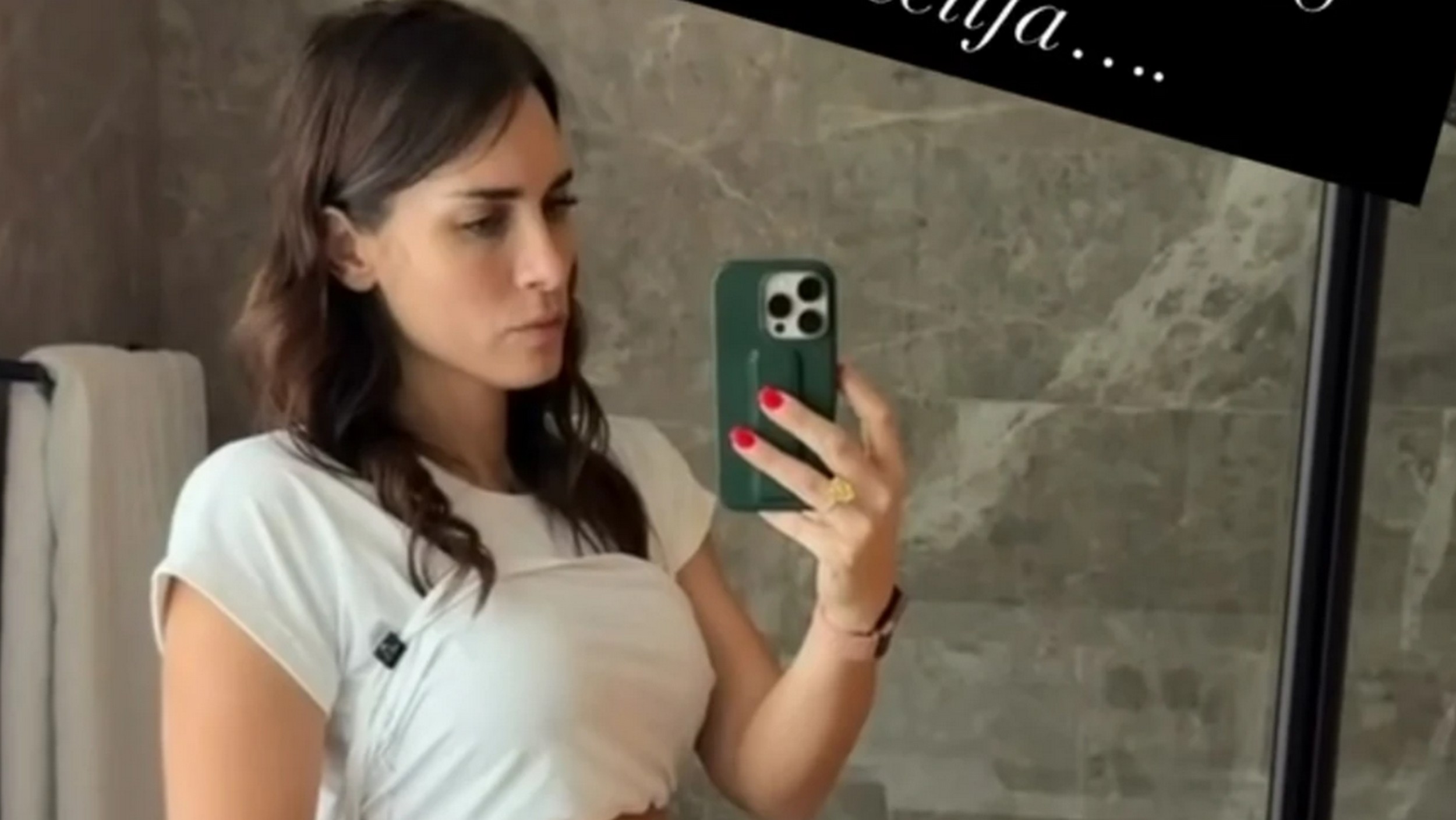 "Nisam trudna..." Manekenka pokazala kako joj telo izgleda nakon hormonalnih terapija: "3. proces vantelesne"