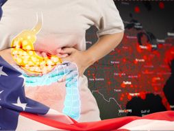 epidemija dijareje u americi,mapa SAD-a, Zastava SAD