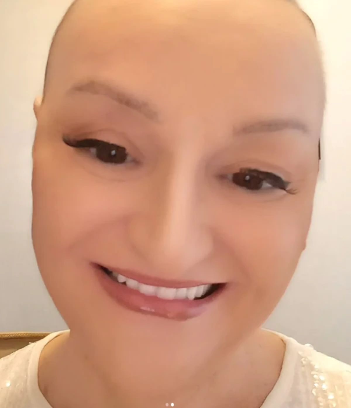 "Ostala sam bez kose jer se lečim od zloćudne bolesti" Milica Dugalić o borbi sa kancerom: "Želim da živim"