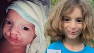RUGAJU MI SE MAMA, ZEZAJU ME Mali Despot na meti vršnjaka zbog rascepa usne: Majka uputila apel koji lomi srce