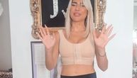 Jovana se nakon operacije oglasila iz svog salonca od 200.000 evra: Nakon izlaska sa klinike, uradila 1. OVO