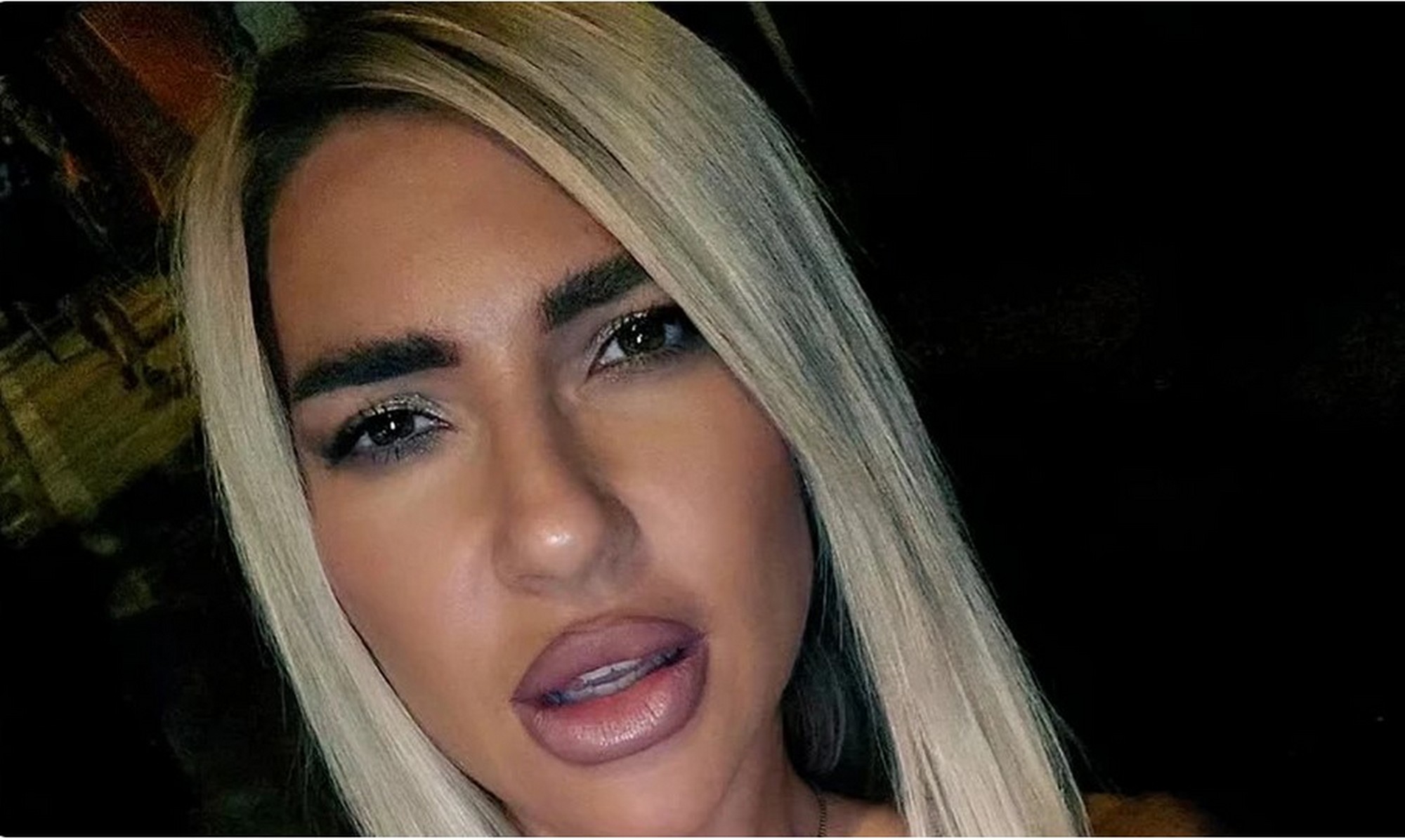 Jovana šeta ulicom u medicinskom brusu za grudi! Voditeljka ugradila silikone a sada je napravila pometnju