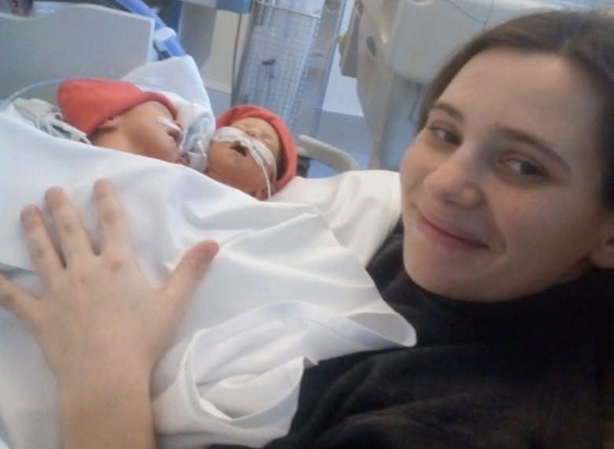 Valentina i Kristina su rođene kao sijamske bliznakinje, a pogledajte ih danas! Doktori sa Balkana izveli čudo