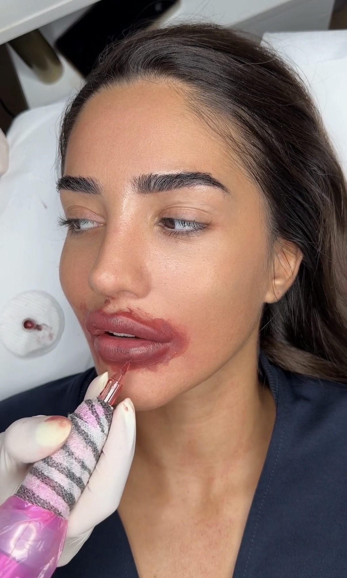 Anđela zgrozila javnost, šta joj se desilo sa licem? Ovjavila video, pa je urnisali u komentarima