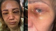 "Nek se plaši Boga! Reagujte dok još..." Pevačica se oglasila o užasnom nasilju koje je doživela Kika Živković