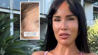"MOJE DETE JE PRETUČENO" Aleksandra Subotić objavila potresne slike ćerke, na licu i vratu ogrebotine