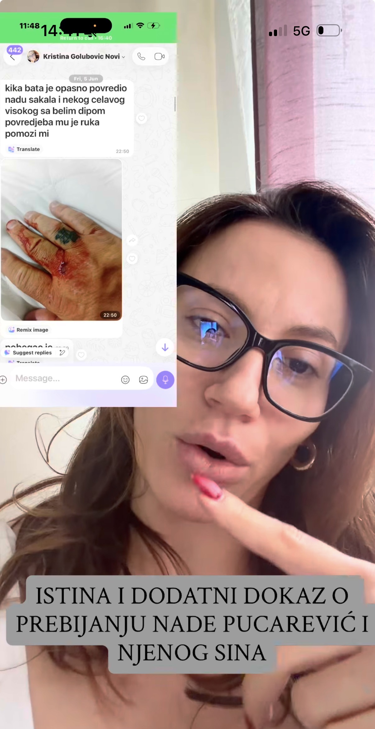 Kristina objavila dokaze, tvrdi da je Kristijan tukao Nadu: Njegova sestra uslikala krvavu pesnicu
