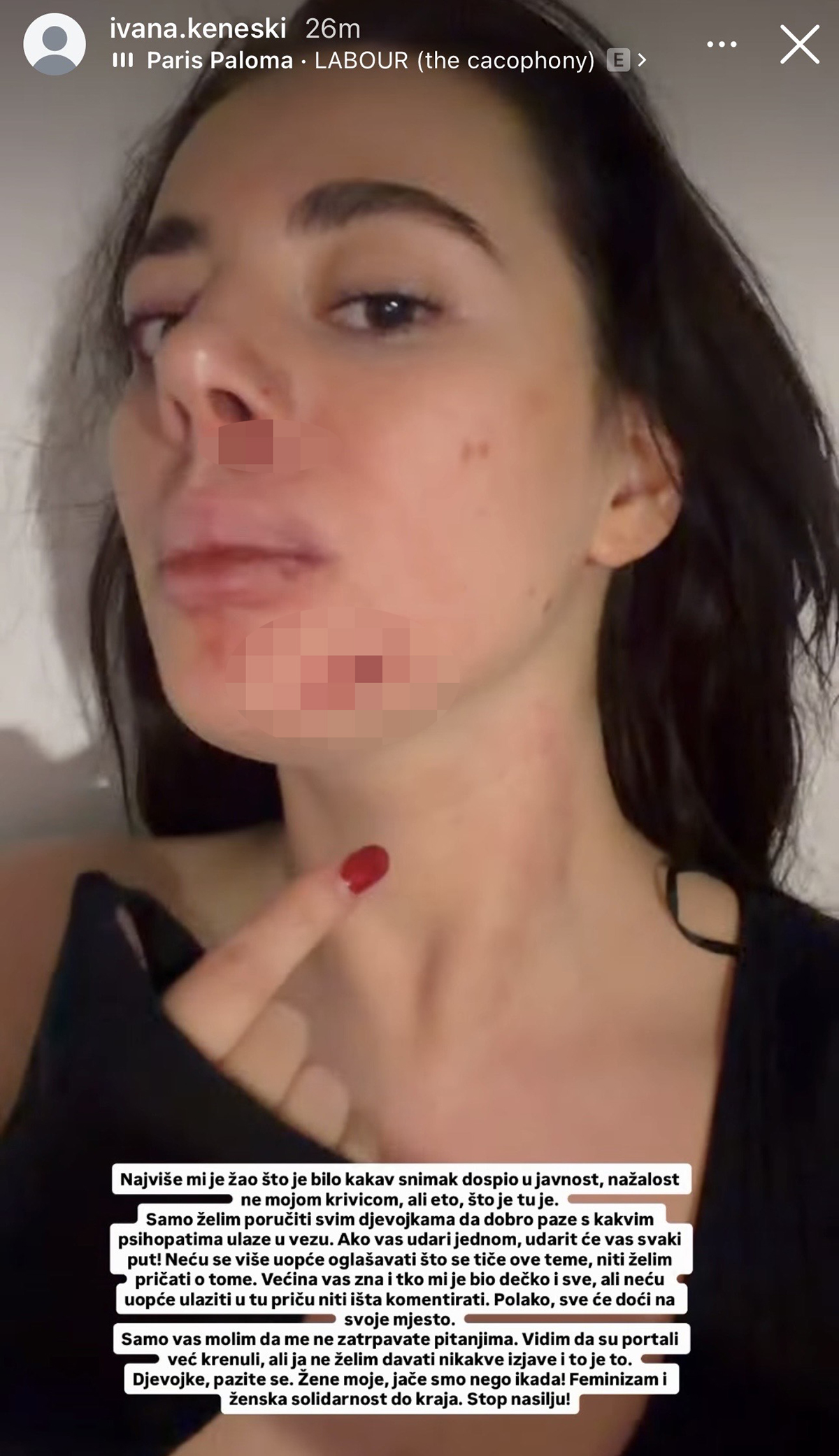 Jezive fotografije pretučene zadrugarke - lice u podlivima, oko poluzatvoreno: Oglasila se usred noći