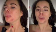 Jezive fotografije pretučene zadrugarke - lice u podlivima, oko poluzatvoreno: Oglasila se usred noći